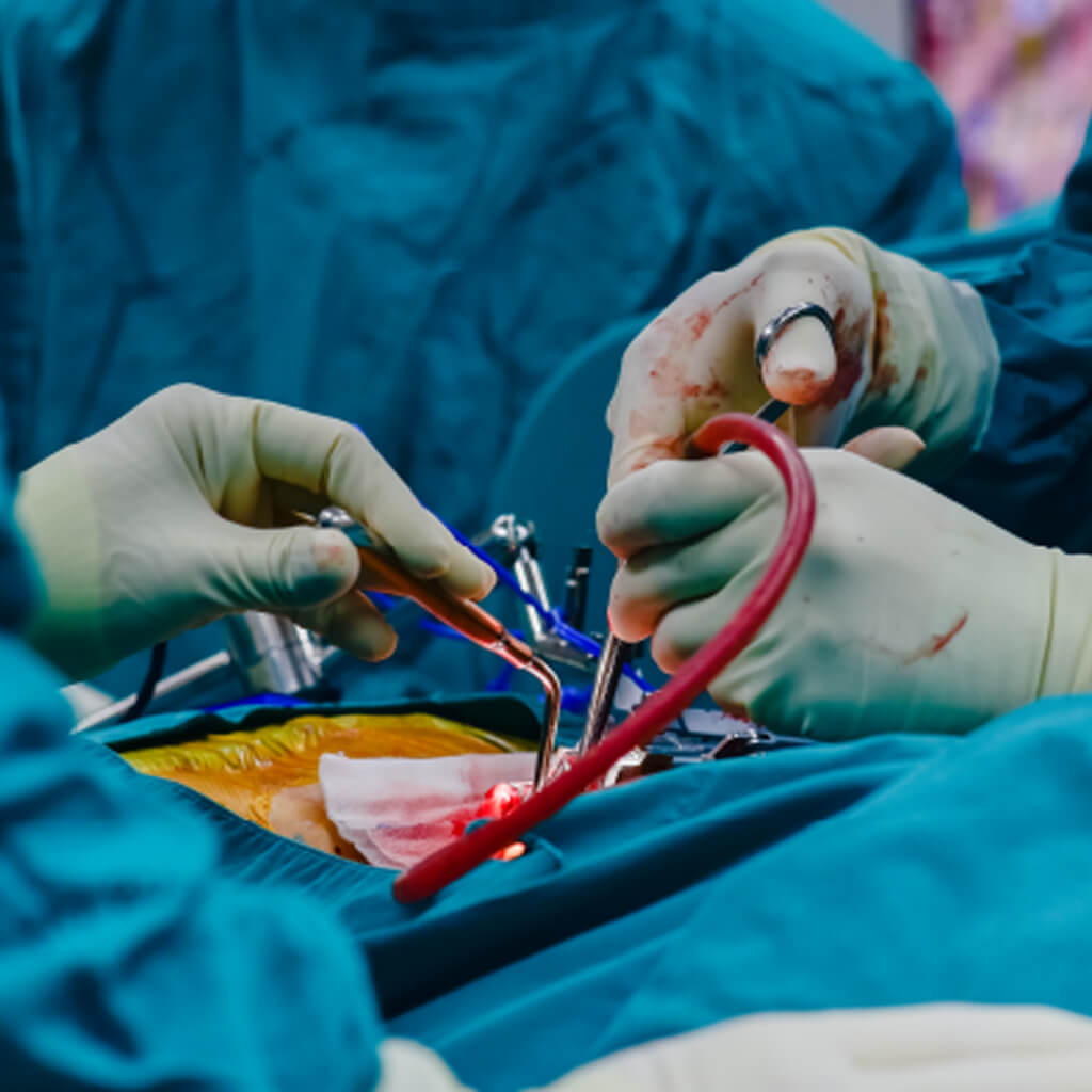 Pancreatic surgery: operative mortality in many hospitals is too high