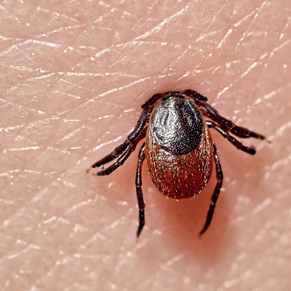 莱姆病及其症状