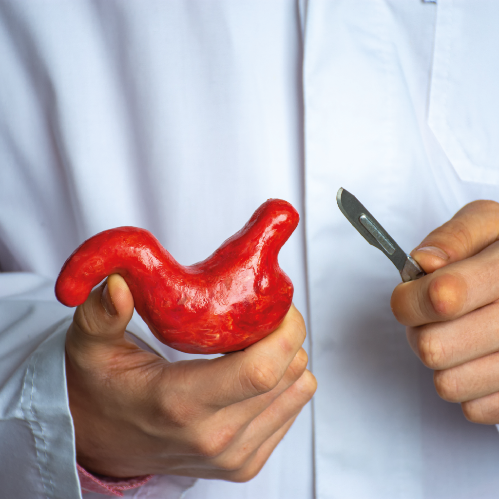 Obezitatea și chirurgia bariatrică: ce trebuie să știți?