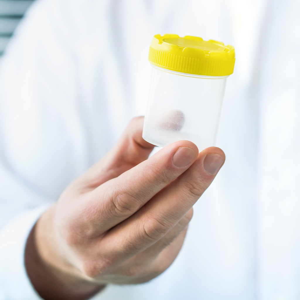 Spermograma: ce este și când poate fi efectuată