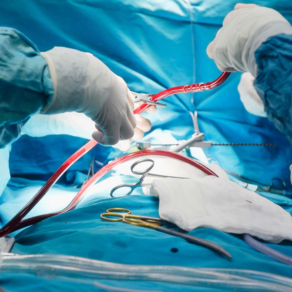 A 7-month-old girl saved thanks to a delicate pediatric heart surgery