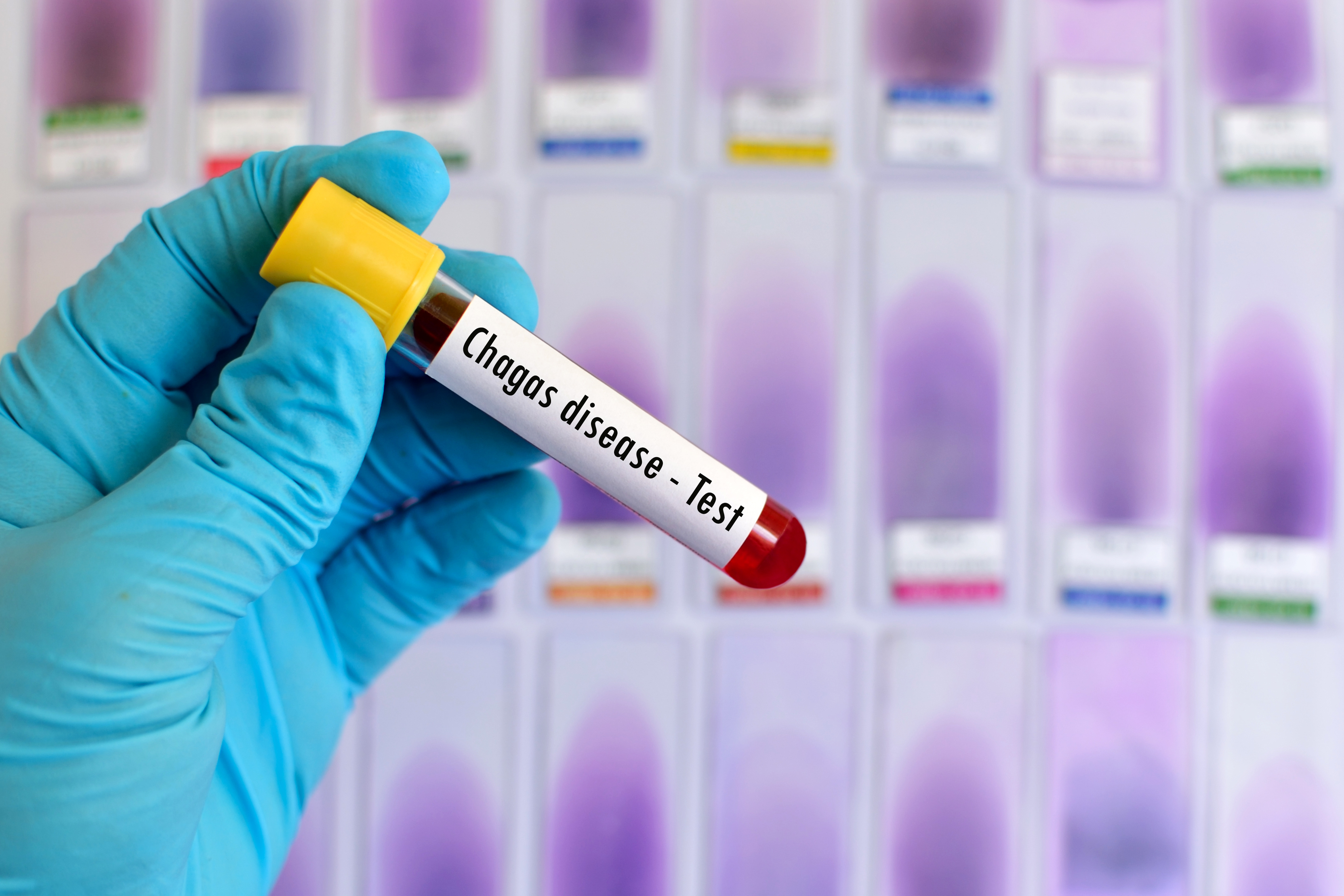 Chagas disease: what it is and how it is transmitted?