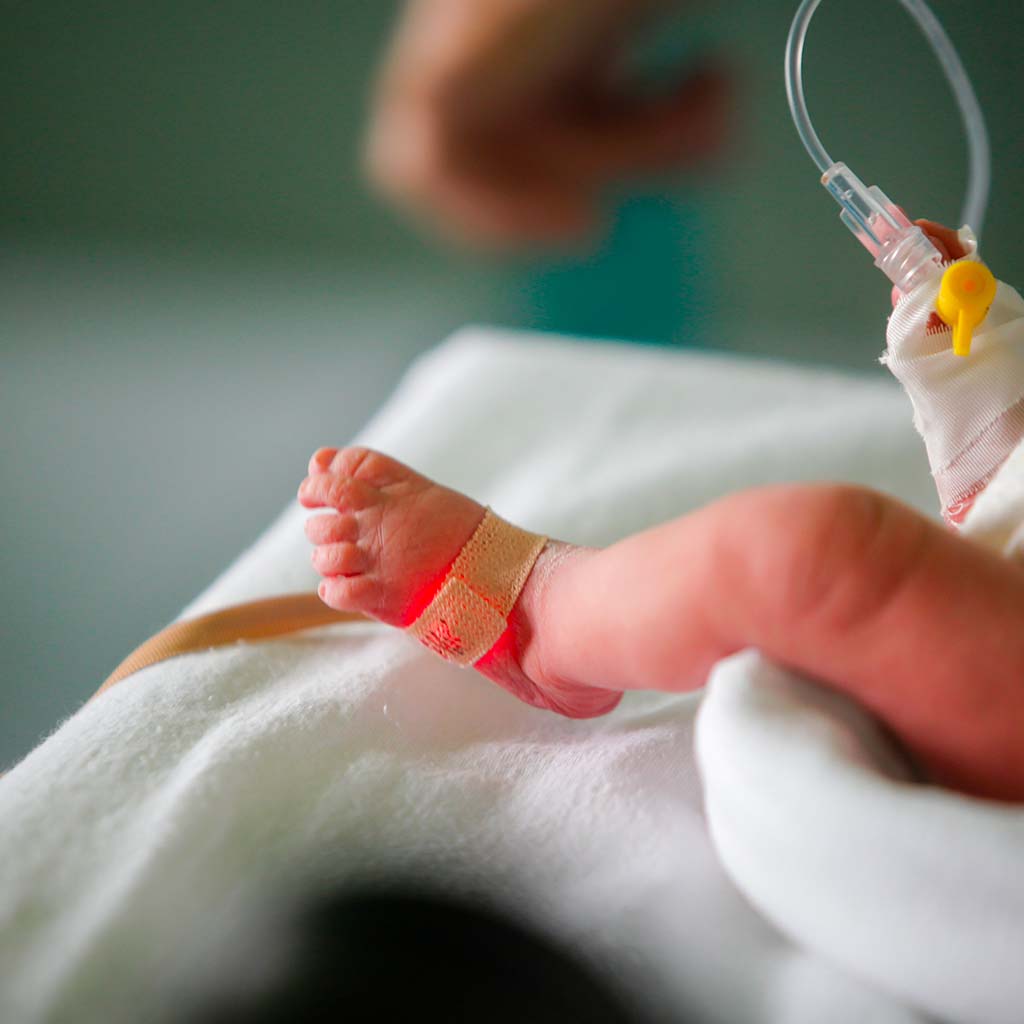 Highly complex cardiac surgery on a 15-month-old girl at the Policlinico San Donato