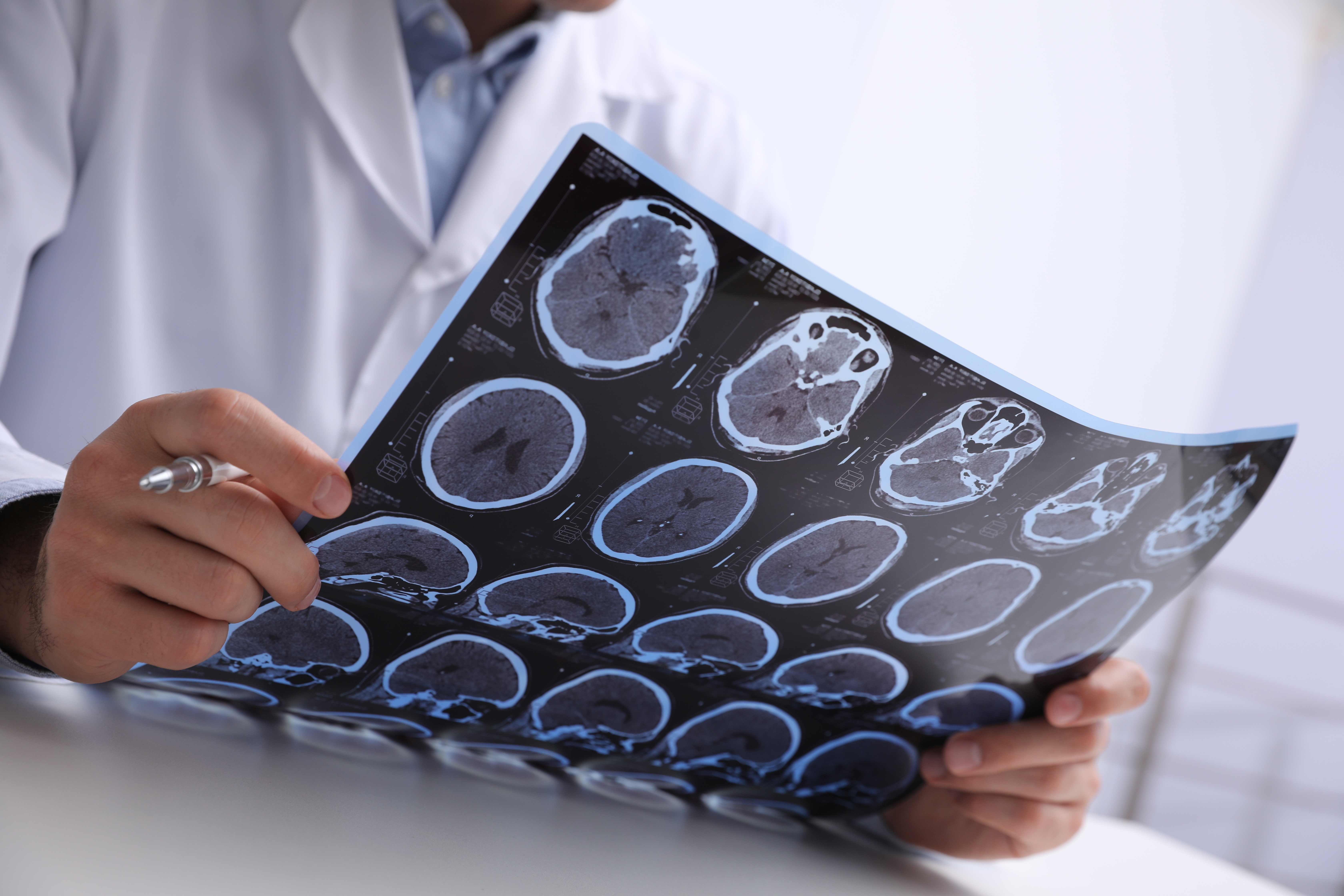 Multiple sclerosis: what are the symptoms and available treatments?