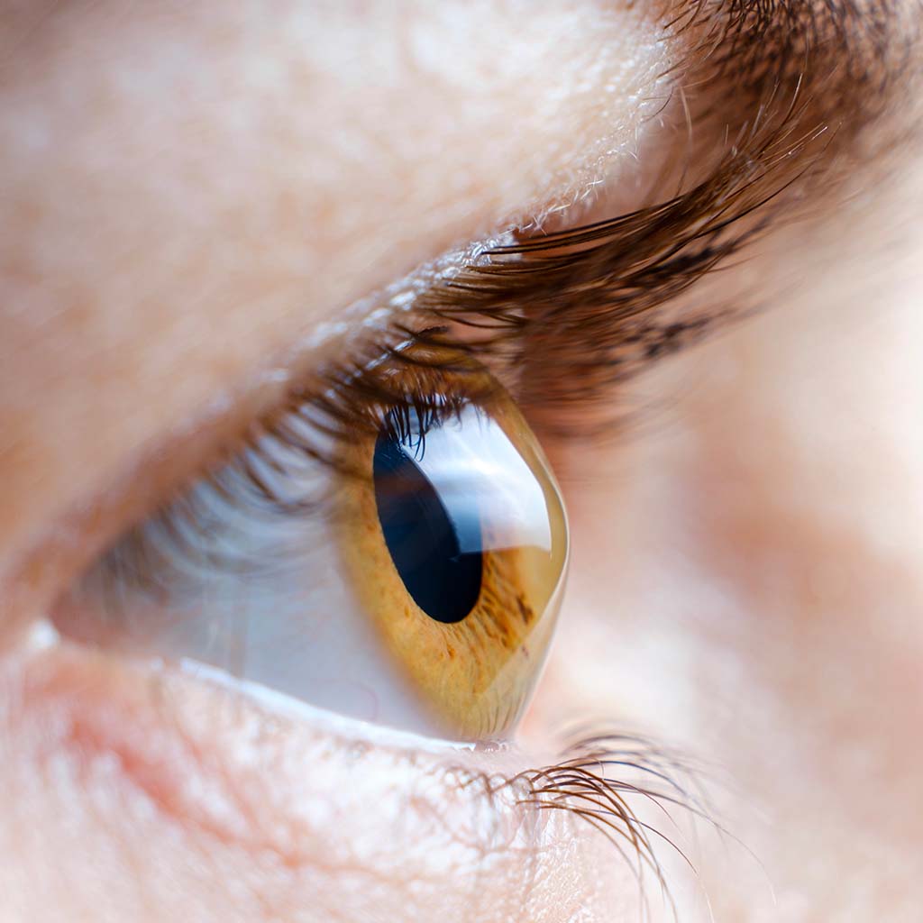 What is ocular tonometry and when should it be done?