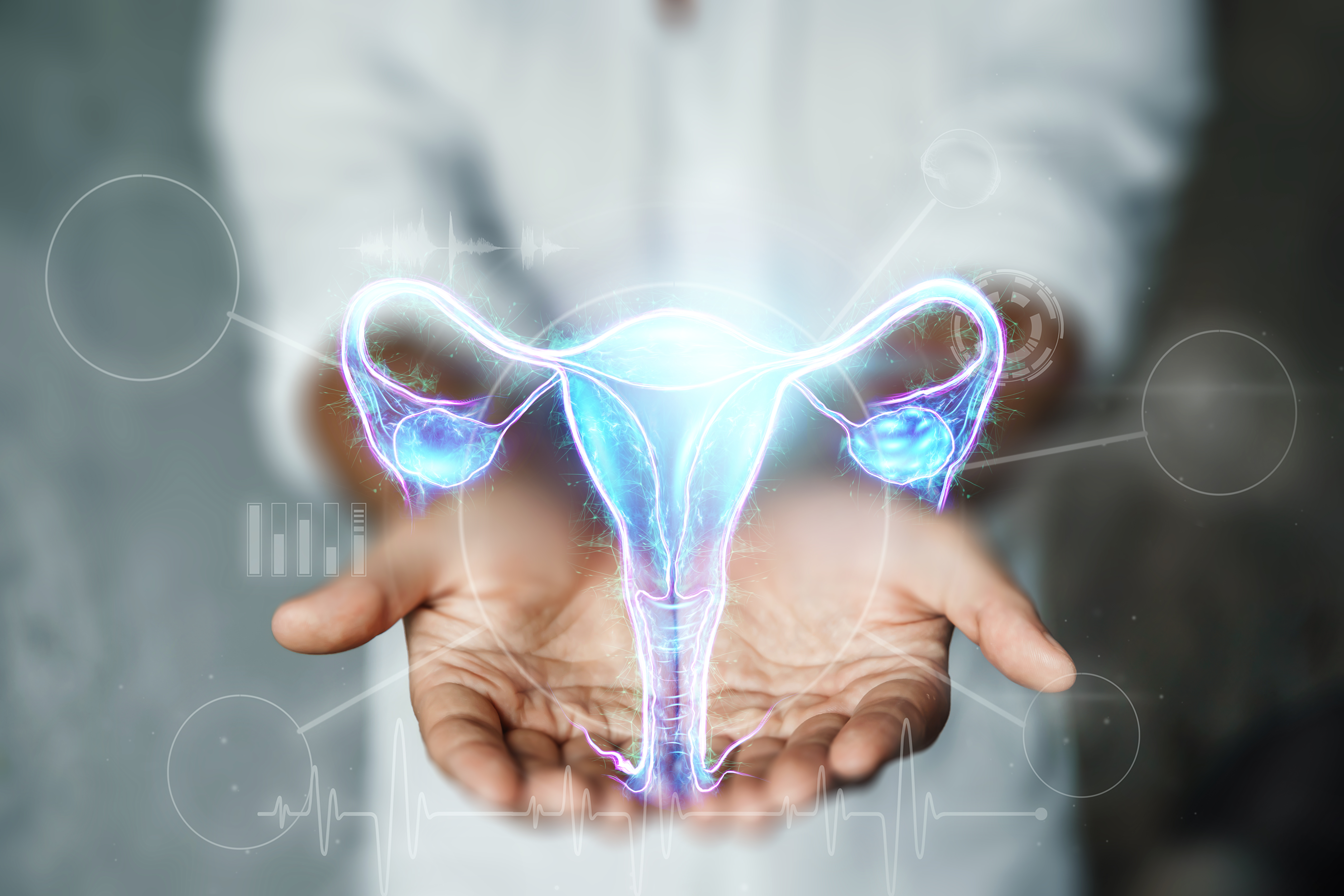 What is the dermoid cyst of the ovary and how it is treated?