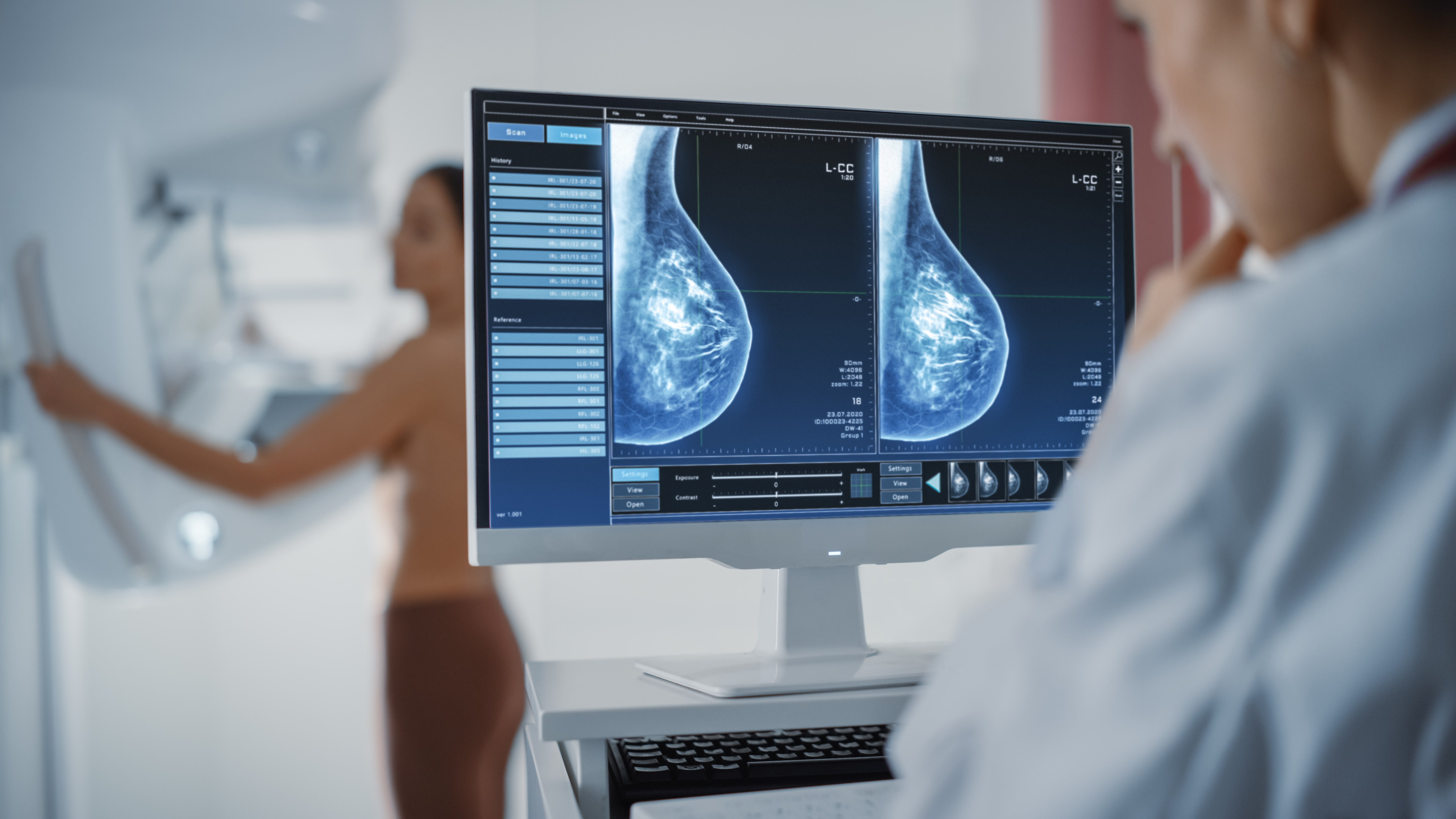 Tomosynthesis or 3D-like mammography: what is it and why is it better than 2D?