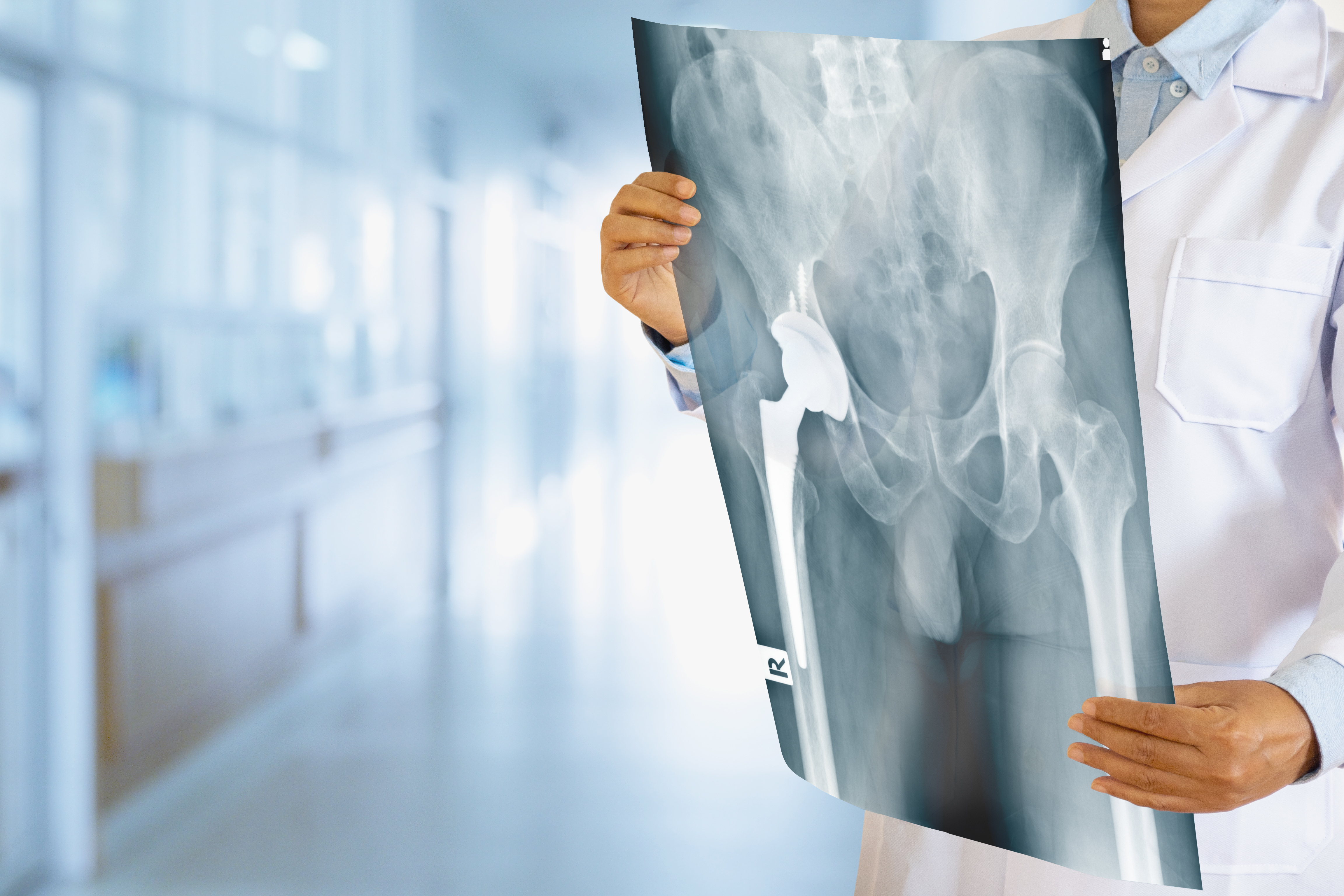 What are the main causes of sacrum pain?